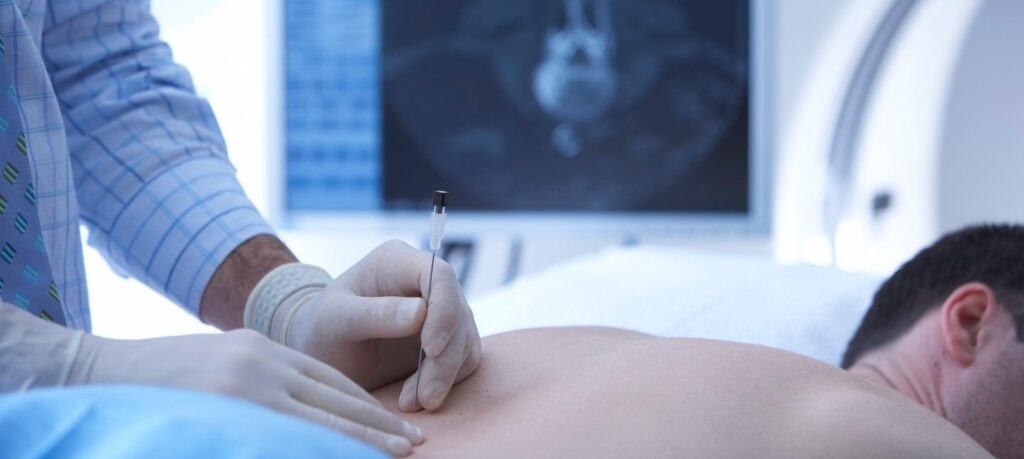 Interventional Radiology Procedures