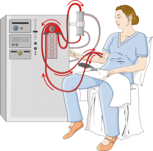 Dialysis Treatment in Nashik | NIMS